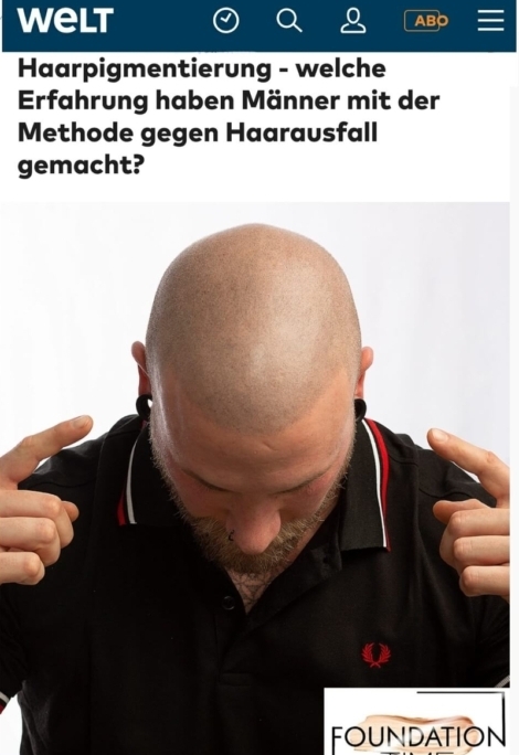 WELT: Haarpigmentierung – welche Erfahrung haben Männer mit der Methode gegen Haarausfall gemacht?