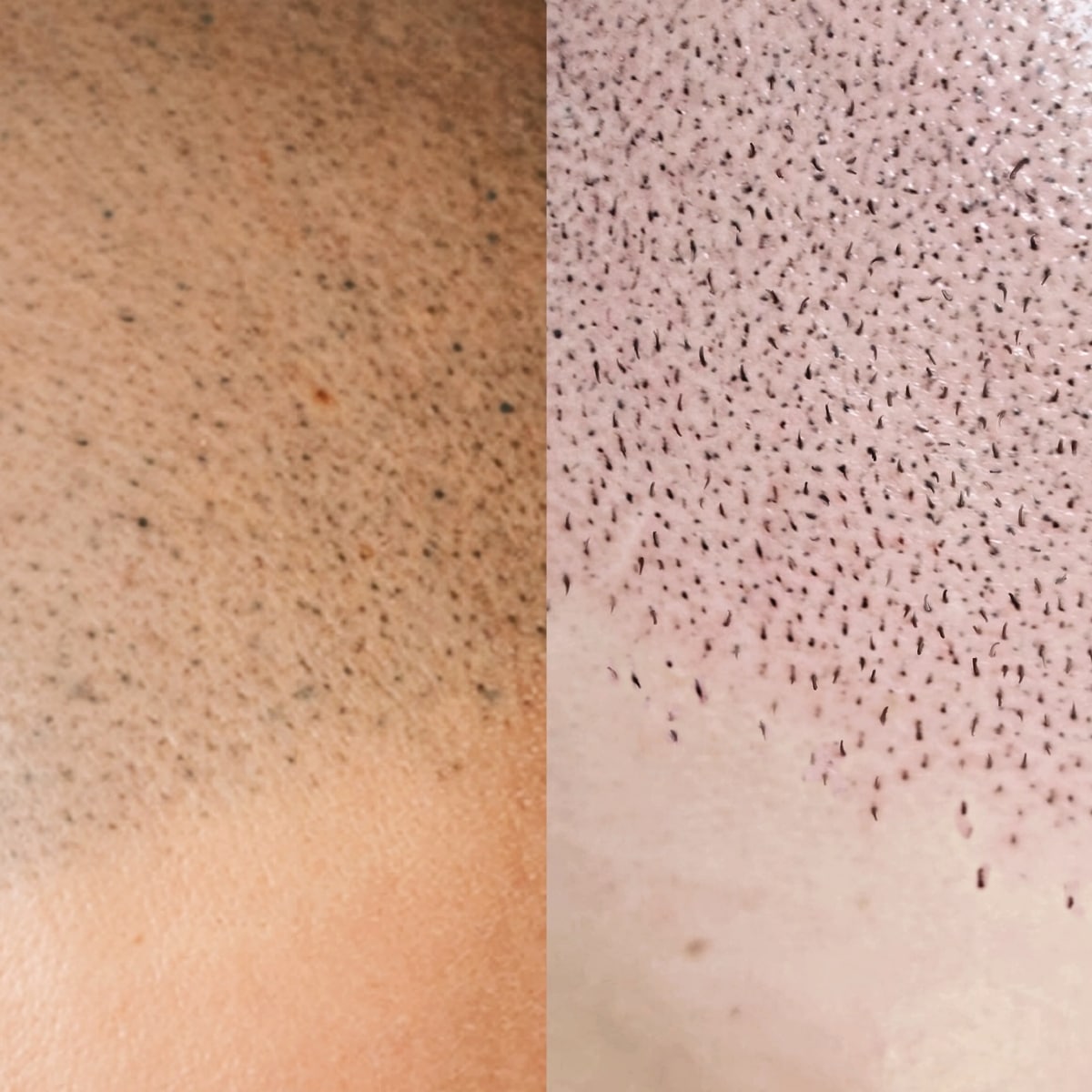 Haarpigmentierung Vergleich zur 4D-Technik