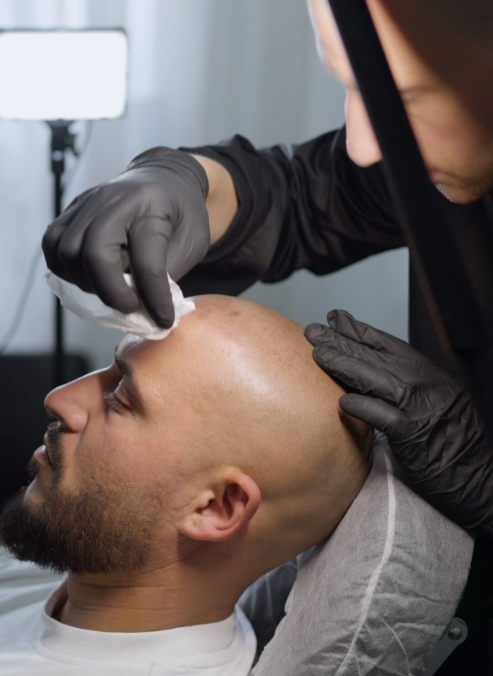 Haarpigmentierung Raum Köln / Bonn - Vorteil B